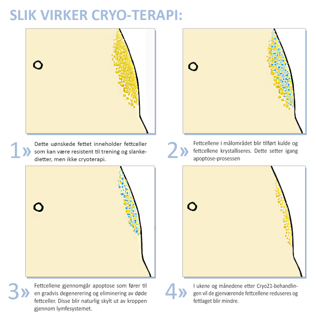 Cryo-prosessen2